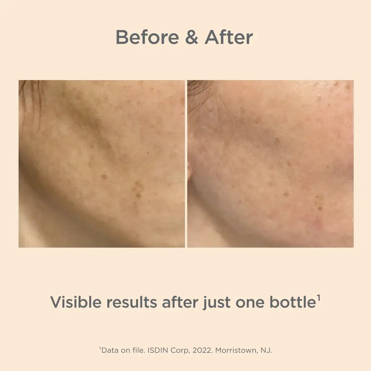 Melaclear Advanced Refill