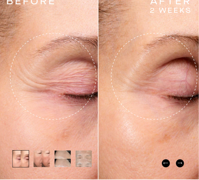 Advanced Regenerative Serum