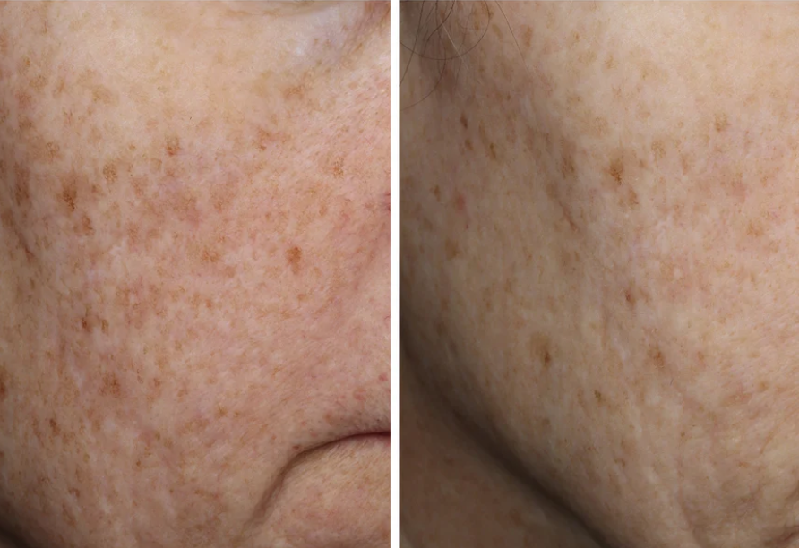 Complexion Brightening Serum