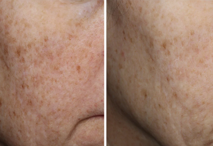 Complexion Brightening Serum