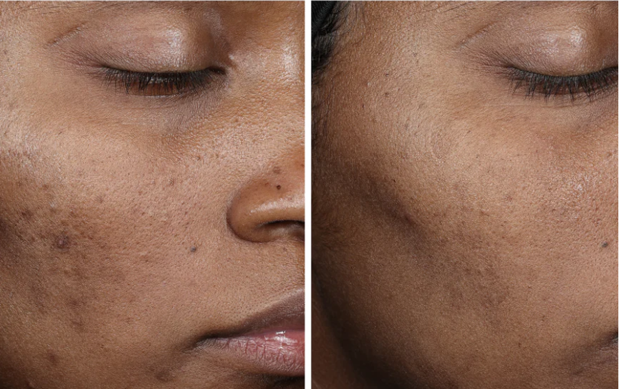 Complexion Brightening Serum