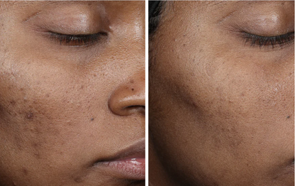 Complexion Brightening Serum